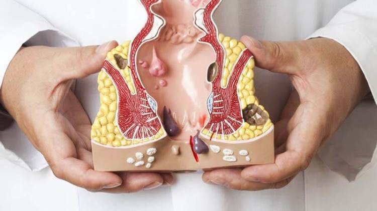 Jual Ambejos Salep Salwa Herbal Denature Di Muna